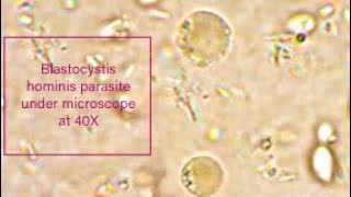 Blastocystis hominis parasite under microscope at 40X [upl. by Aeslehc]