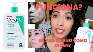 CERAVE GEL LIMPIADOR ESPUMOSO  FUNCIONA [upl. by Barker459]