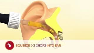 How to use Otex Olive Oil Ear Drops [upl. by Reidid]