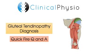 Abdominal Tendinopathy  Causes and Treatment Including Exercises [upl. by Hulburt380]