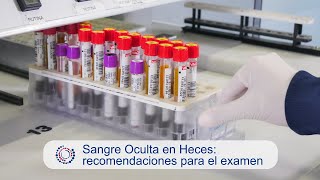 Sangre Oculta en Heces recomendaciones para el examen [upl. by Annnora]