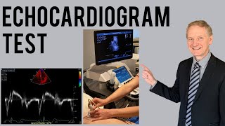 Echocardiogram Procedure  Heart Ultrasound  Everything you need to know [upl. by Nirtiac]