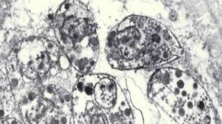 Toxoplasmosis amp Toxoplasma gondii [upl. by Nitsrek700]