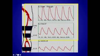 The Doppler Effect explained visually [upl. by Llerreg]