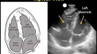 Ultrasound Tutorial DVT  Lower Limb Veins  Radiology Nation [upl. by Stone]