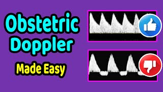 Obstetric Doppler Made Easy [upl. by Nywroc]