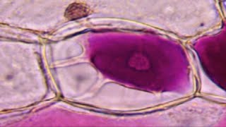 Plasmolyse vs déplasmolyse avec éclatement de la membrane cytoplasmique SVT Kempf Elorn [upl. by Mosi275]