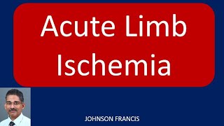 Acute Limb Ischemia [upl. by Irreg]