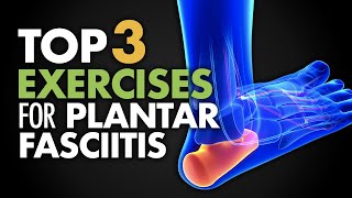 Plantar Fasciitis Causes Diagnosis and Treatment [upl. by Calle]