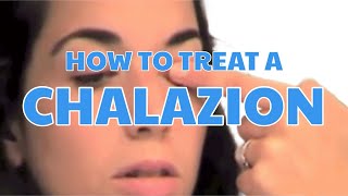 How to treat a chalazion [upl. by Newol]