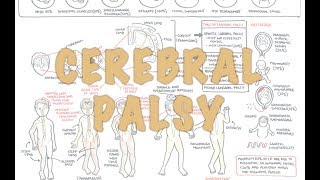 Cerebral Palsy  DETAILED Overview [upl. by Lorrac577]