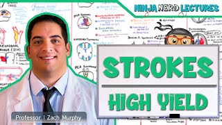 Ischemic and Hemorrhagic Strokes  High Yield [upl. by Eedrahc714]