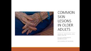 Common Skin Lesions in Older Adults [upl. by Hsak]