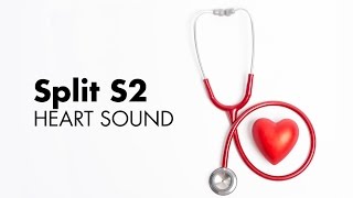 Fixed Split S2  Heart Sounds  MEDZCOOL [upl. by Josi124]