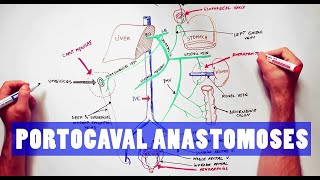 Portocaval Anastomoses  ANATOMY Tutorial [upl. by Reinar]