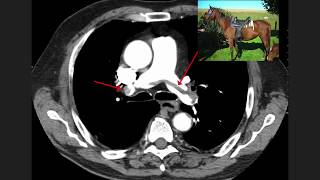 High Yield CT Scans Part 1  USMLE [upl. by Nossah]