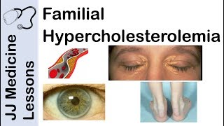 Types of Hyperlipidemia I–V – Cardiovascular Pathology  Lecturio [upl. by Negiam]