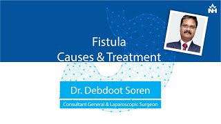 Anal Fistula Causes Symptoms amp Treatment Options  Dr Debdoot Soren [upl. by Artimas530]