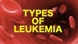 Leukemia  USMLE [upl. by Blaire]