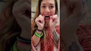 Most HONEST Review of Pop On Veneers You must watch this if youre thinking of getting veneers [upl. by Minier]