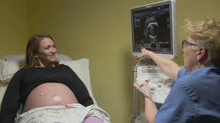 Ultrasounds during pregnancy [upl. by Emirac]