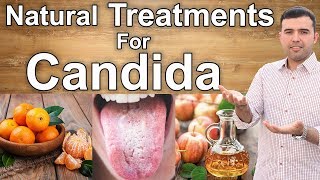 Natural Remedies for Candida  How to Cure Candida Fungus Effectively [upl. by Marv520]