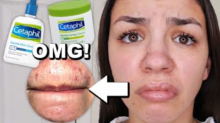 I Used Cetaphil Skincare For One Week [upl. by Yrojram]