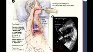 Fibrilación Auricular en Urgencias ¿Que hago [upl. by Milah]