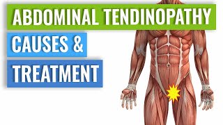 How to Fix Hamstring Tendonitis No More HIP PAIN [upl. by Tace]