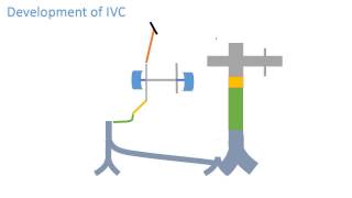 Inferior vena cava development [upl. by Seana]