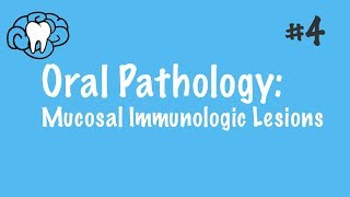 Oral Pathology  Mucosal Immunologic Diseases  INBDE ADAT [upl. by Chiquia917]