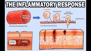 THE INFLAMMATORY RESPONSE [upl. by Valma]