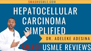 Hepatocellular Carcinoma Lecture Simplified [upl. by Aissatan]