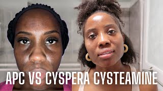 APC Cysteamine vs Cyspera Cysteamine [upl. by Lienhard]