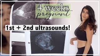 4 Weeks Pregnant  Early Ultrasound and Ectopic Pregnancy Scare [upl. by Nnaegroeg]