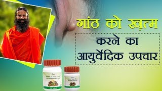 Ayurvedic Treatment for Lipoma गांठ  Swami Ramdev [upl. by Rossing196]