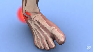 Ankle Strengthening Top 3 Exercises by Physical Therapists [upl. by Ynad]