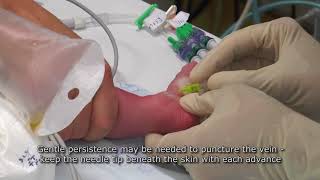 Paediatric Anaesthetics Chapter 7  Long saphenous IV neonate 1 [upl. by Jule]