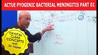 Acute Pyogenic Bacterial Meningitis Part 1 🩺 [upl. by Richel]