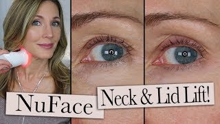 NuFace Trinity ELE  Wrinkle Reducer Review  Eyelid Lift  Neck Wrinkles [upl. by Zippora869]