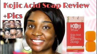 SKIN LIGHTENING SOAP Koji White Kojic Acid Skin Lightening Soap Review  BeautyByAJ [upl. by Ecinahs]