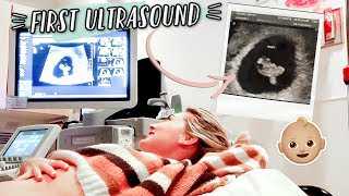 FIRST PREGNANCY ULTRASOUND  HEARING BABYS HEARTBEAT [upl. by Natam]