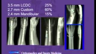 Orthopaedic Grand Rounds Contemporary Perspectives in Distal Radius Fracture Fixation [upl. by Daffie]