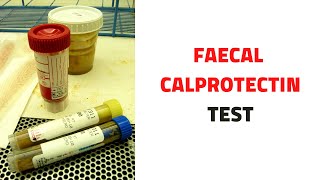 FECAL STOOL CALPROTECTIN TEST Uses Inflammatory Bowel Disease [upl. by Martinson949]