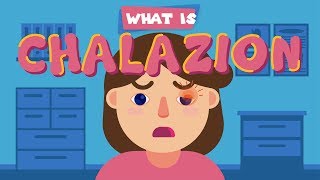 What is Chalazion [upl. by Crysta]