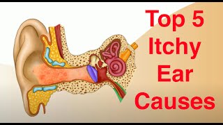 Top 5 Causes of Itchy Ears and Treatment Too [upl. by Seften]