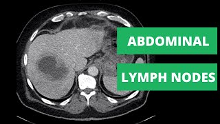 Abdominal CT Lymph Node Stations  How to read a CT [upl. by Possing]