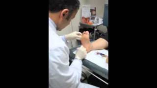 Botox 201 Hyperhidrosis treatment underarm sweating [upl. by Eadwine]