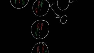 Robertsonian translocation 21q14q [upl. by Roxi]