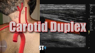 Carotid Duplex Exam [upl. by Tilda471]